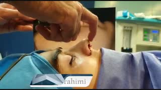 عمل زیبایی بینی پهن و دارای انحراف و فرورفتگی | دکتر ابراهیمی