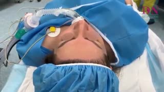 فیلم جراحی بینی به روش باز