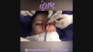 جراحی بینی | دکتر رفیع