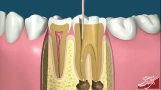 نمونه تولید محتوای ویدیویی | راهنمای لبخند