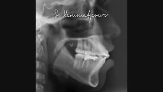 اجرای نمونه درمان به صورت انیمیشن | راهنمای لبخند