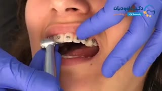 اجرای پست ویدیویی به همراه طراحی کاور پست | راهنمای لبخند