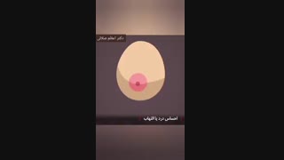 علائم سرطان سینه