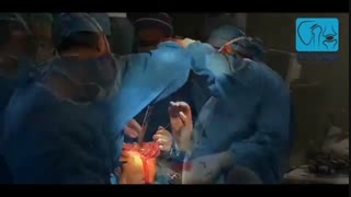 فیلم جراحی مفصل زانو