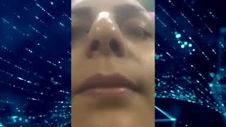 فیلم رضایت بیمارپس از عمل بینی