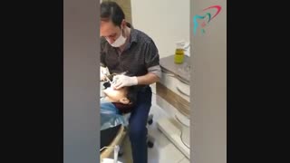 درمان ۸ واحد ونیر کامپوزیت