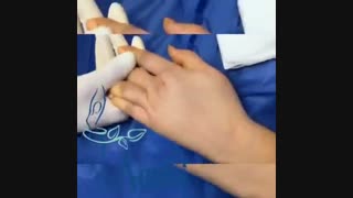 تزریق چربی به دست بررسی لک صورت