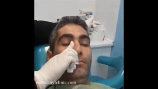 از بین بردن سیاهی و گودی زیر چشم فقط در یک ساعت