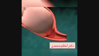 فیلم شماتیک زایمان طبیعی