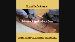 لیزر کیوسوئیچ 09120132883 دستگاه تتو پاک کن