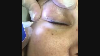 کلیپ کار با دستگاه پلاسما مگلو