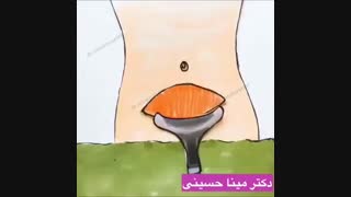 انیمیشن سزارین