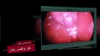 فیلم عمل جراحی کیسه صفرا