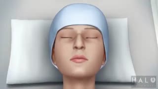 جراحی  بینی - رینوپلاستی- دکتر دوغایی مقدم