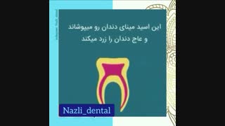 غذاهایی که باعث زرد شدن دندان ها می شود
