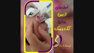 فیلم از بین بردن کک و مک با لیزر