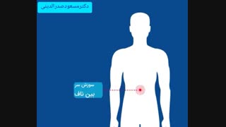 زخم معده چیست و از علائم آن چه می دانید ؟
