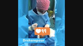 جراحی بلفاروپلاستی