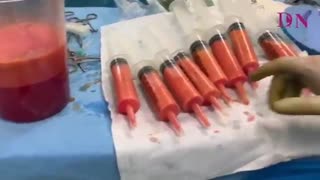 فیلم تزریق چربی به سینه رفع افتادگی پلک