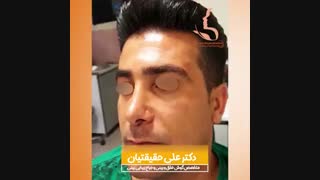 فیلم جراحی بینی در شیراز