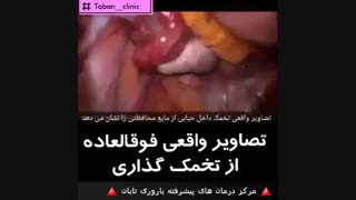 فیلم روند تخمک گذاری
