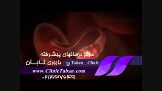 درمان ناباروری با روش آی وی اف