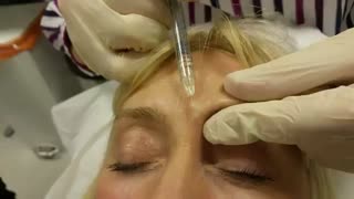 بوتاکس ابرو - دکتر دوغایی مقدم لیپوست