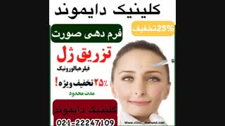 تخفیف ویژه برای تزریق ژل و فرم دهی صورت در کلینیک زیبایی دایموند 02122247108