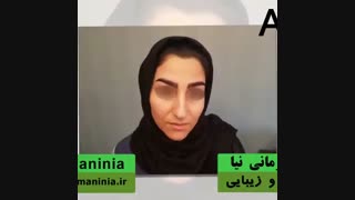کاشت ابرو به روش دلخواه