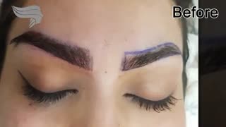 کاشت ابرو به روز