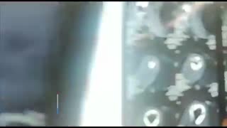 فیلم جراحی پارگی شدید  روتاتورکاف