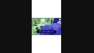 جراحی تعویض مفصل زانو