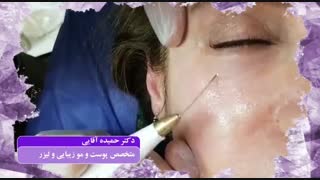 جلوگیری از افتادگی پوست عمل زیبایی