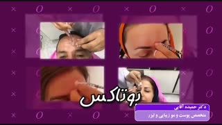 میکرونیدلینگ پلاسماجت