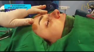 فیلم عمل زیبایی بینی