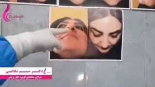 فیلم عمل جراحی زیبایی بینی (قسمت اول)