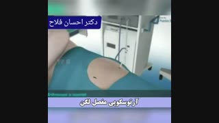 آرتروسکوپی مفصل لگن