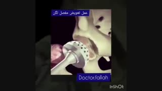 فیلم تعویض مفصل لگن