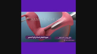 فیلم انجام تست پاپ اسمیر