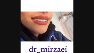 نمونه زیبایی (اصلاح طرح لبخند)