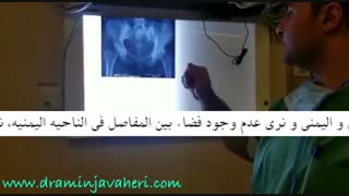 التهاب مفصل الحوض الیساری برداشتن خال گوشتی