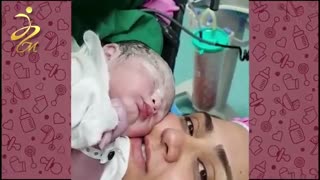 فیلم زایمان سزارین با بی حسی اسپاینال