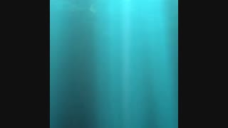 جراحی همزمان لیفت صورت با جراحی بینی و تزریق چربی