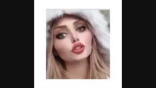 نمونه جراحی بینی با فیلر صورت بوتاکس و ژل لب