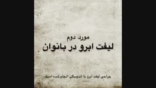 نمونه جراحی لیفت ابرو با آندوسکپ