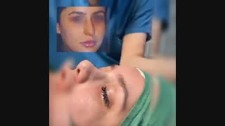 خطر تامپول بعد از جراحی بینی