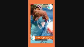 فیلم عمل زایمان سزارین