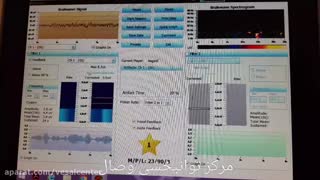 نوروفیدبک با نرم افزار اسمارت مایند (Smart Mind)