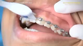 بهداشت ارتودنسی | دکتر سپیده دادگر