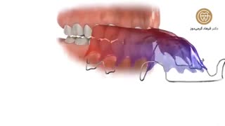 نگهدارنده متحرک | دکتر فرهاد گرجی جوانسازی پوست